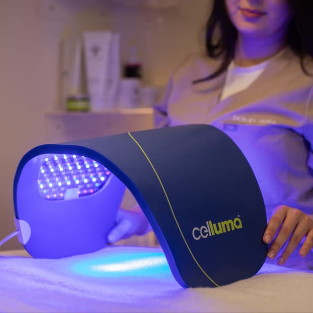 CELLUMA ACNE SCAR RECOVERY at SKIN by Tania in San luis Obispo, CA